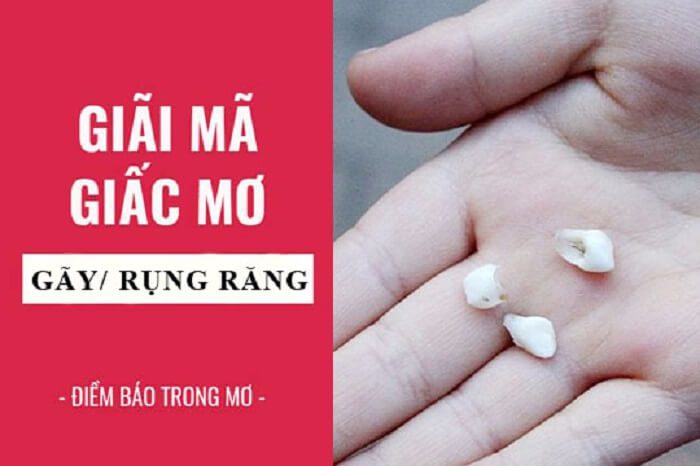 Ý nghĩa nằm mơ thấy rụng răng?