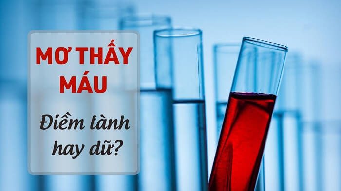 Giấc mơ thấy máu có ý nghĩa gì? 